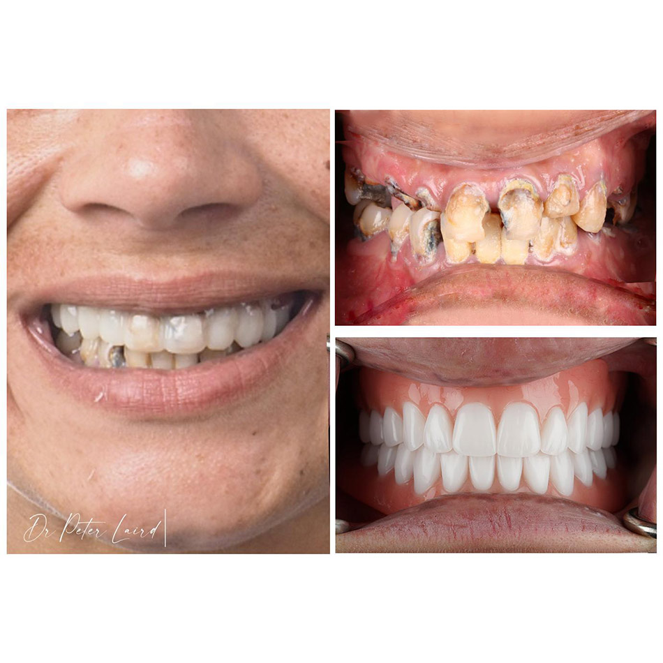 Dental Before and After 6