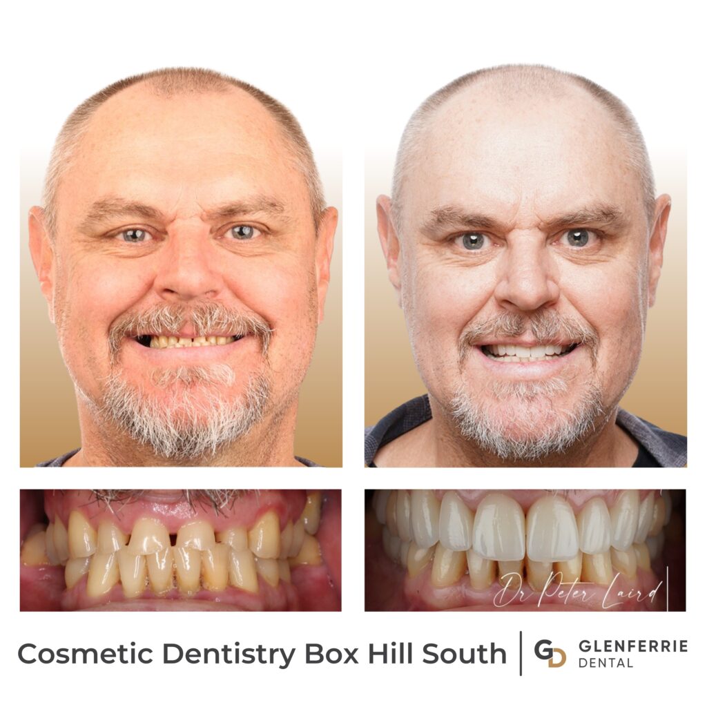 Cosmetic Dentistry Box Hill South
