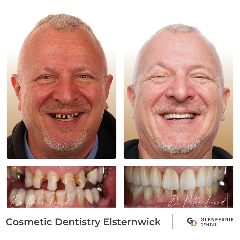 Cosmetic Dentistry Elsternwick