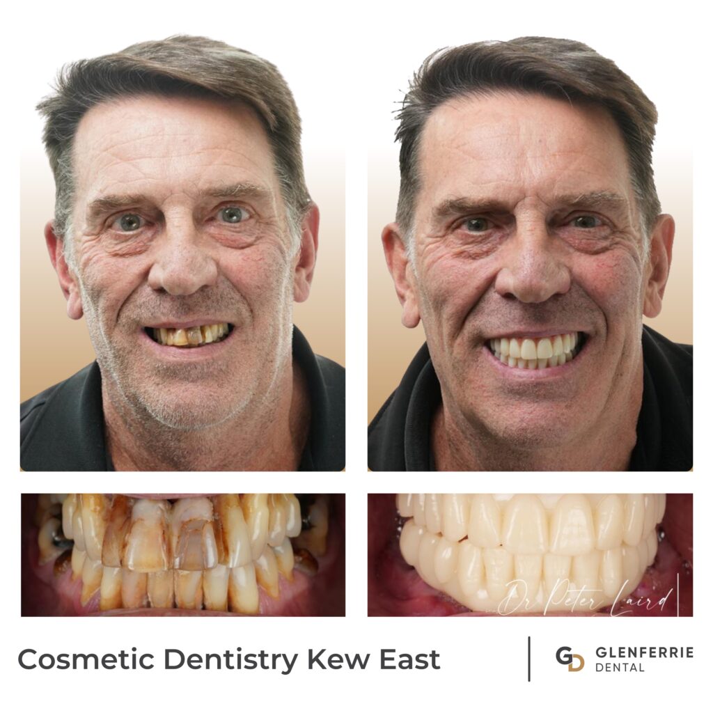 Cosmetic Dentistry Kew East