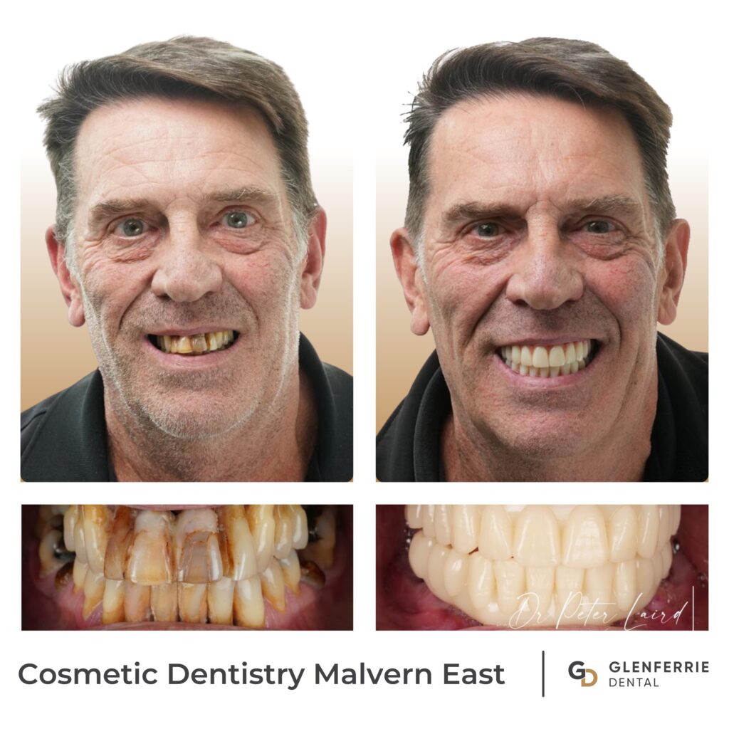 Cosmetic Dentistry Malvern East