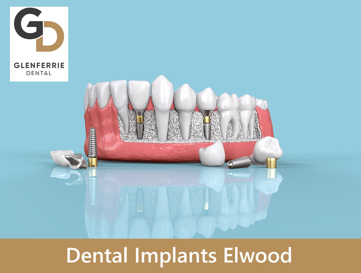 Dental Implants Elwood