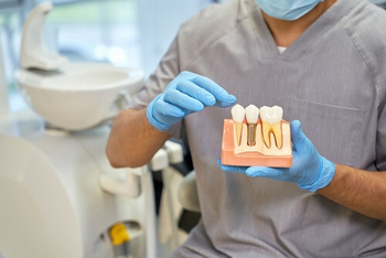 Dental Implants Philippines posts