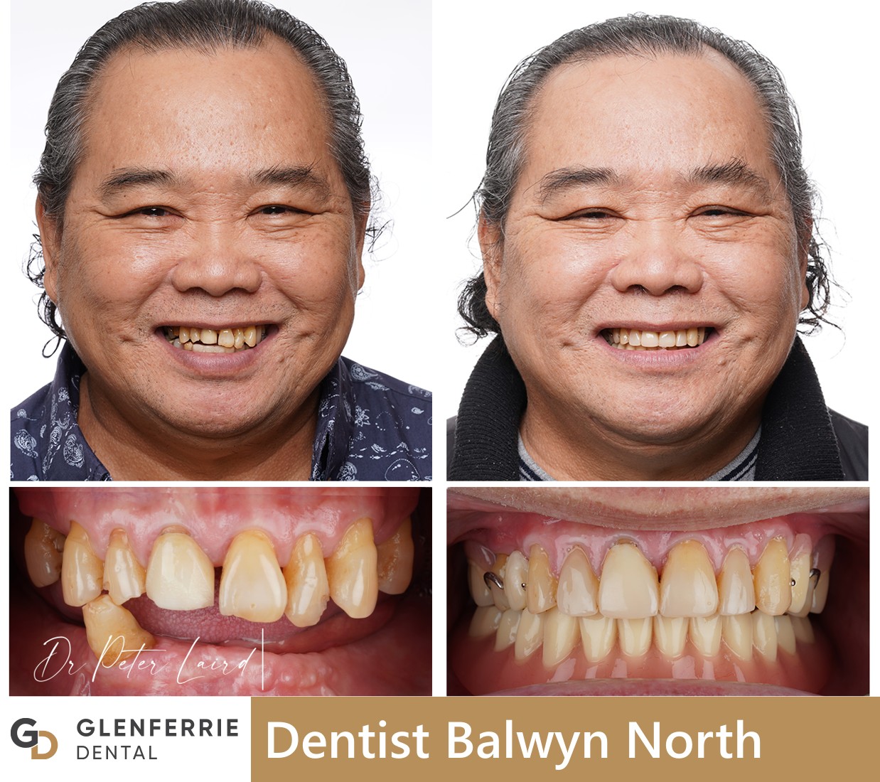 dentist balwyn north
