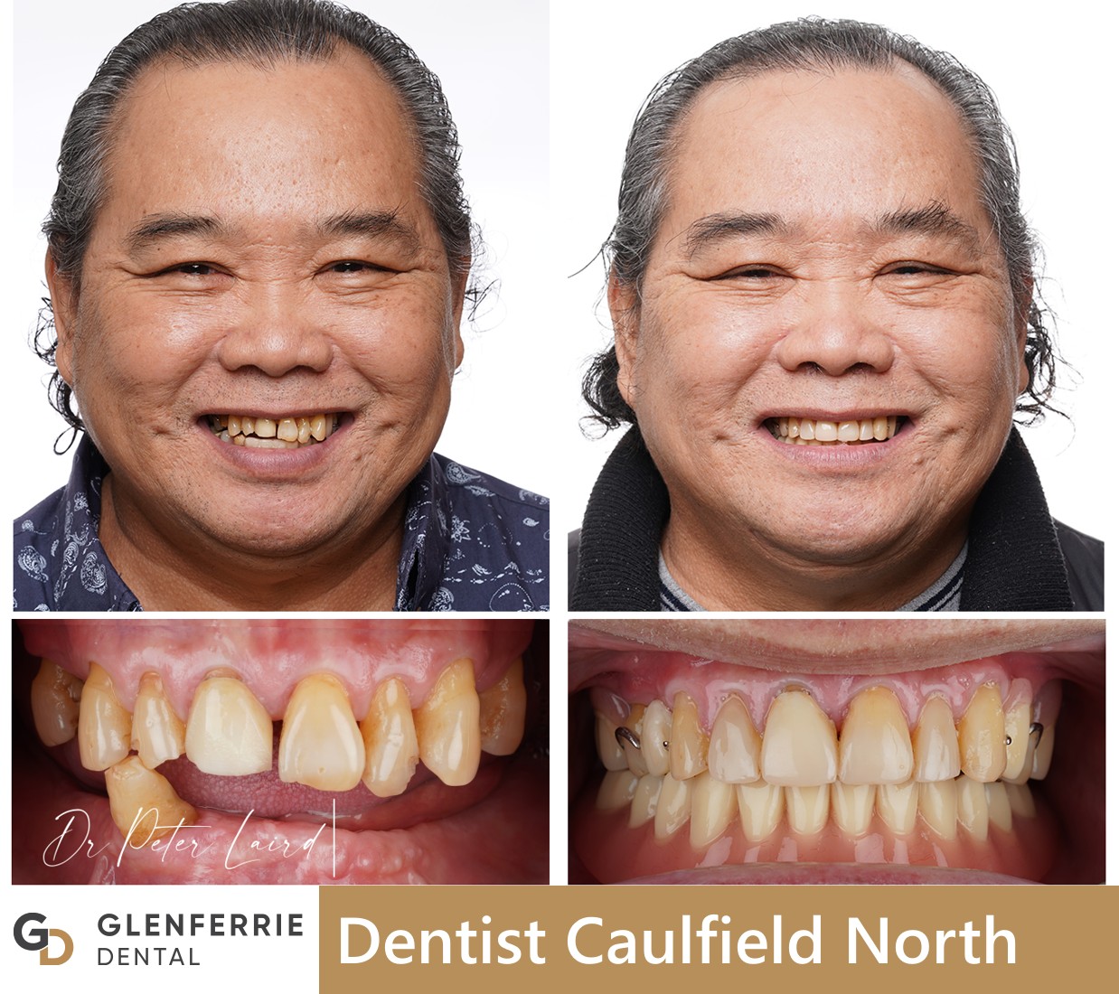 dentist caulfield north