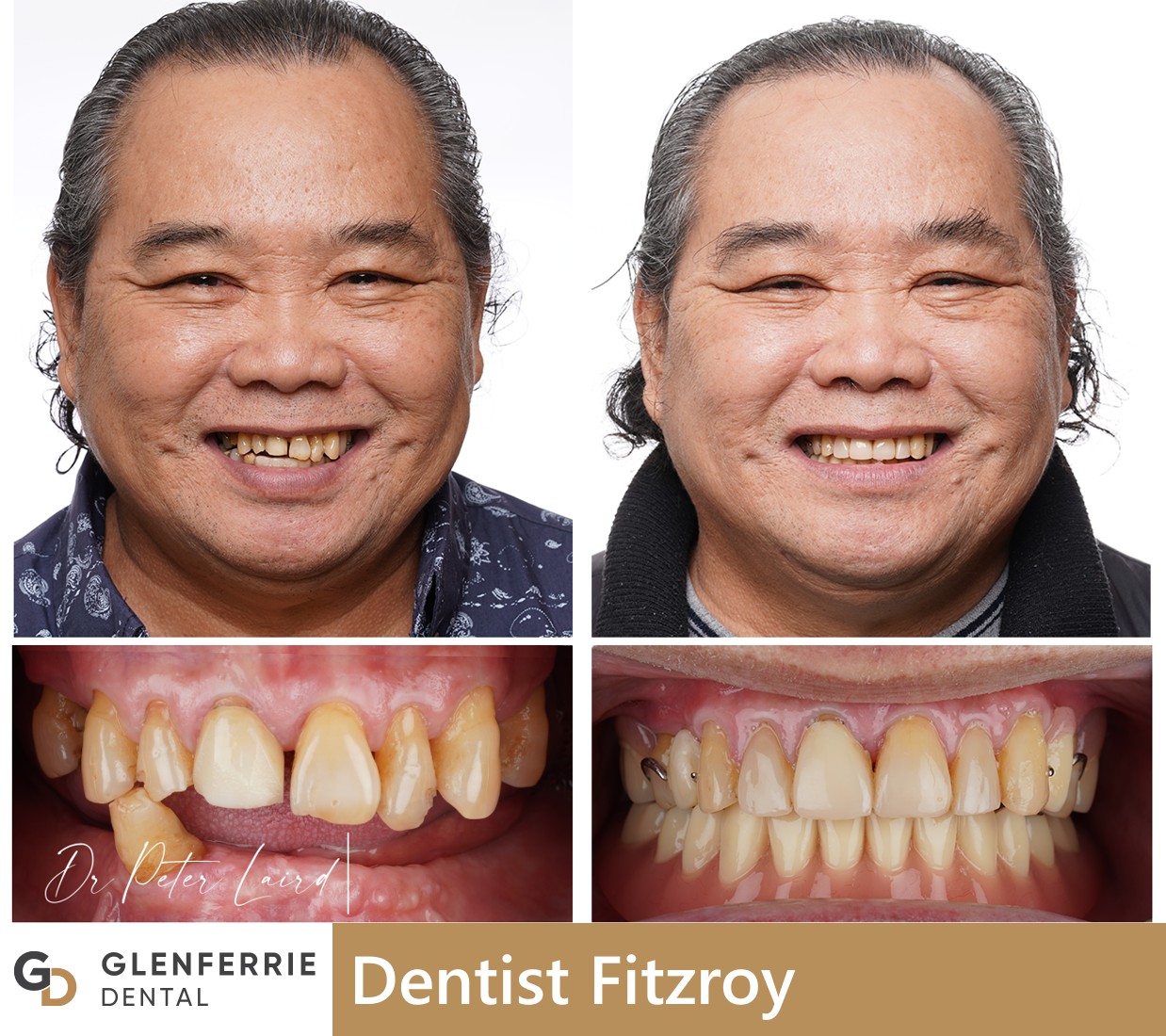 dentist fitzroy