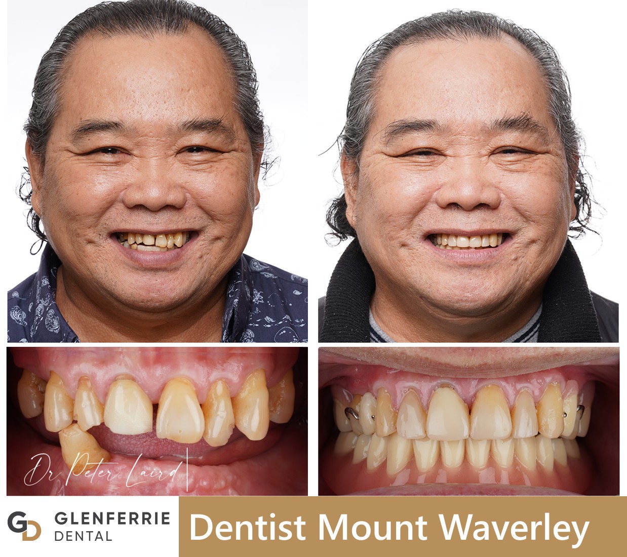 dentist mount waverley