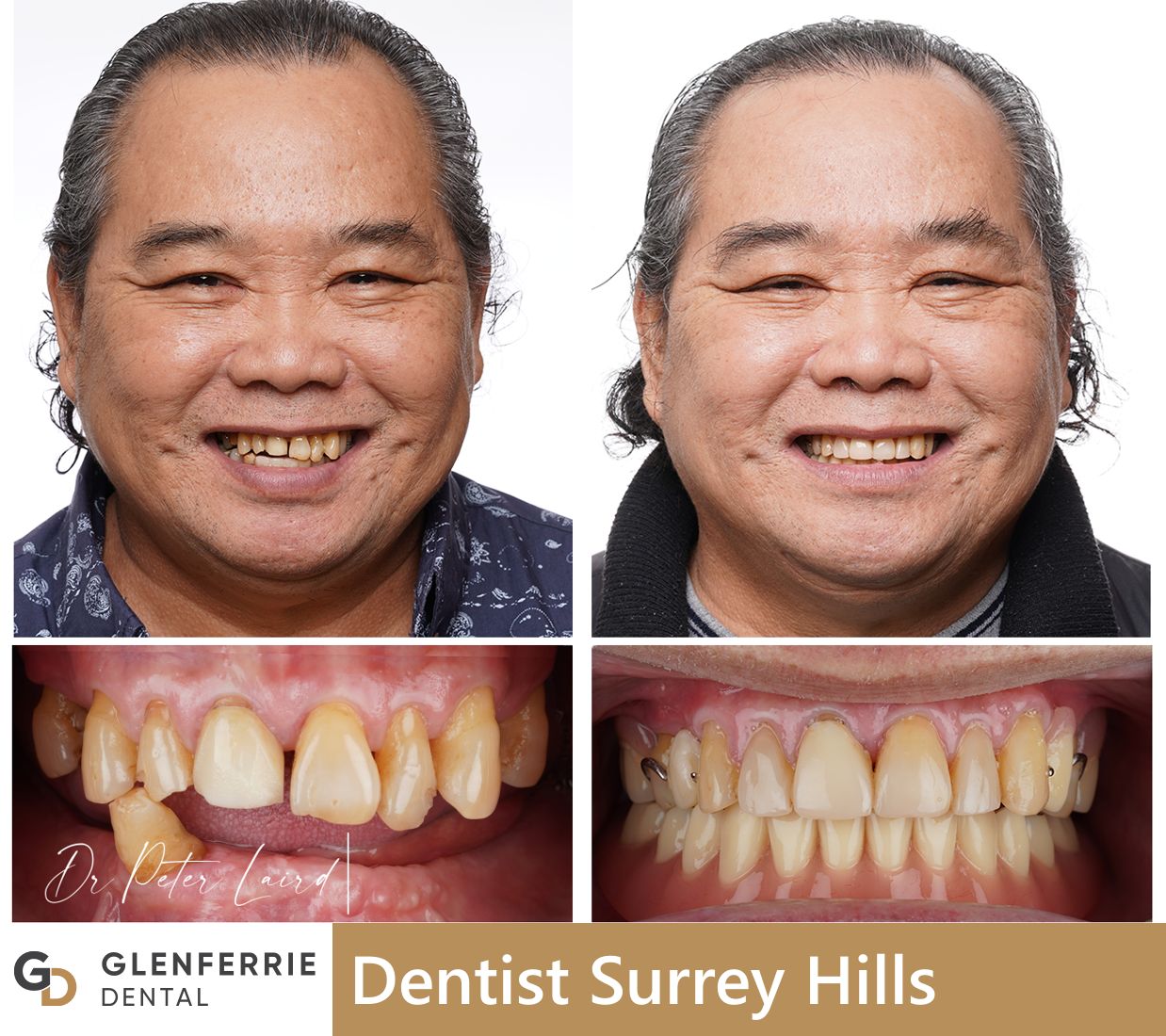 dentist surrey hills